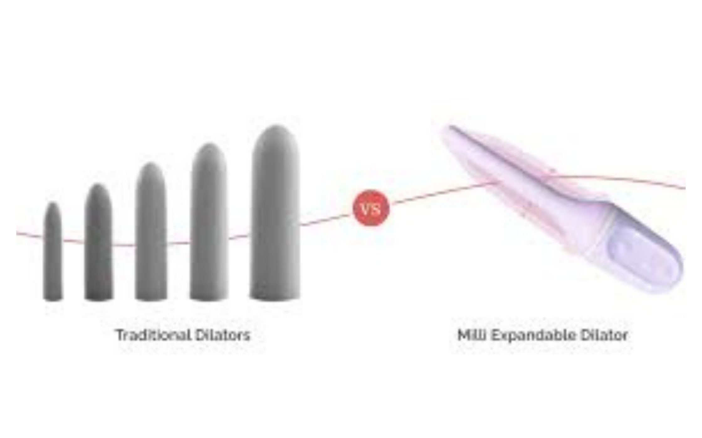 Milli Dialator compared to competition