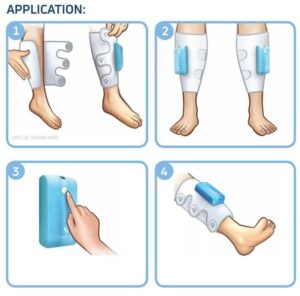 An image showing how to put on a venapro dvt